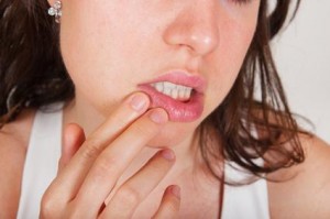 Herpes an den Lippen besteht zwischen 1 Woche und 10 Tagen. gefunden auf: https://www.herpes-lindern.de/symptome-und-verlauf.html